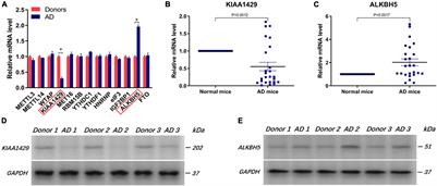 KIAA1429 and ALKBH5 Oppositely Influence Aortic Dissection Progression via Regulating the Maturation of Pri-miR-143-3p in an m6A-Dependent Manner